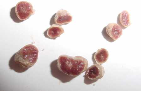 Nódulos de soja, com interior cor de rosa, indicando a presença da leghemoglobina e, consequentemente, de um processo ativo de fixação de nitrogênio