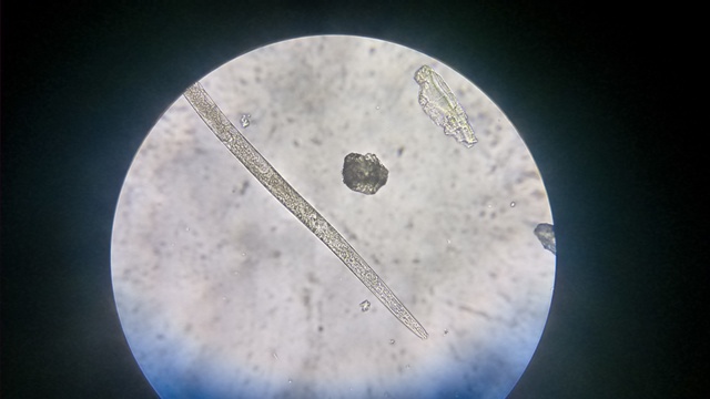 Confirmação da soja louca II no algodoeiro em microscópio - Créditos Juliana Aparecida Homiak