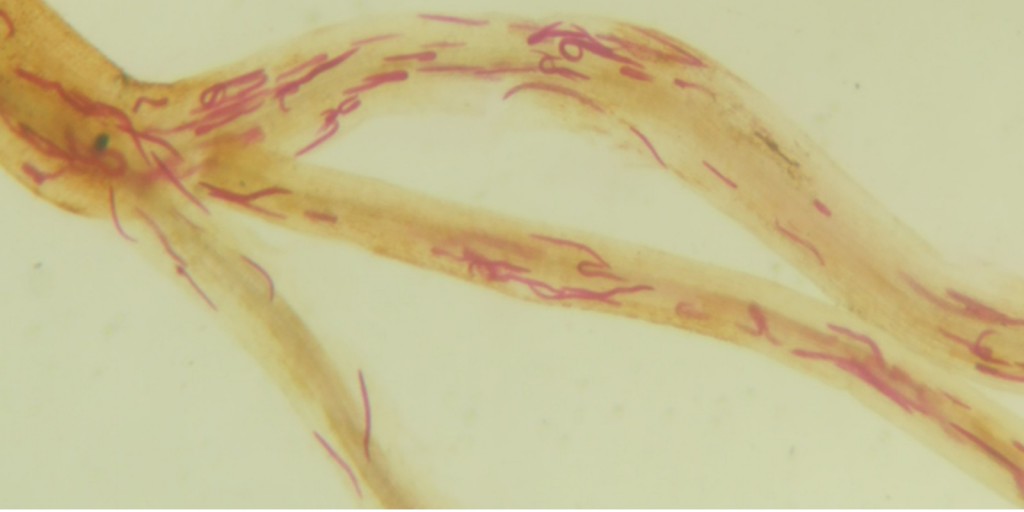 Pratylenchus brachyurus no interior de raízes de soja cultivada em solo infestado pelo nematoide - Créditos: Ricardo Bemfica Steffen